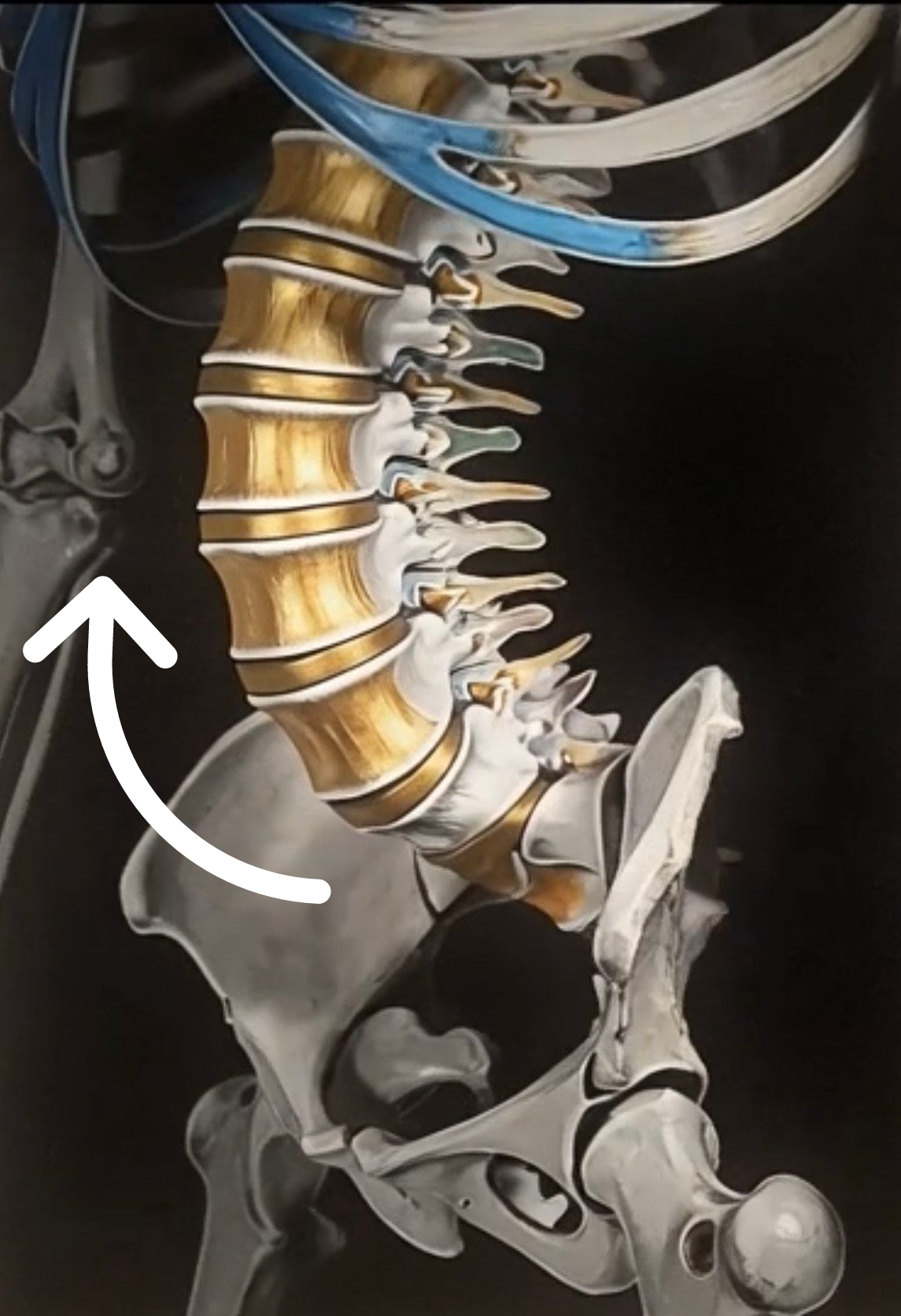 Increased lower back curvature