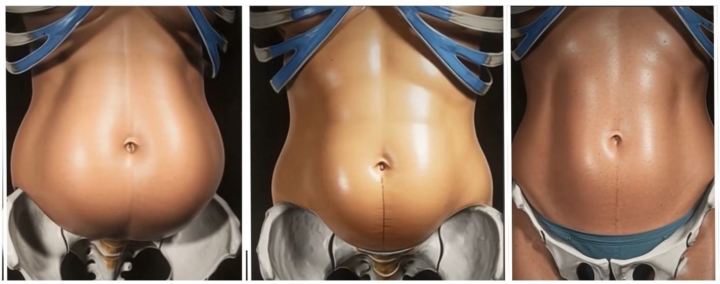 abdomen and core strength