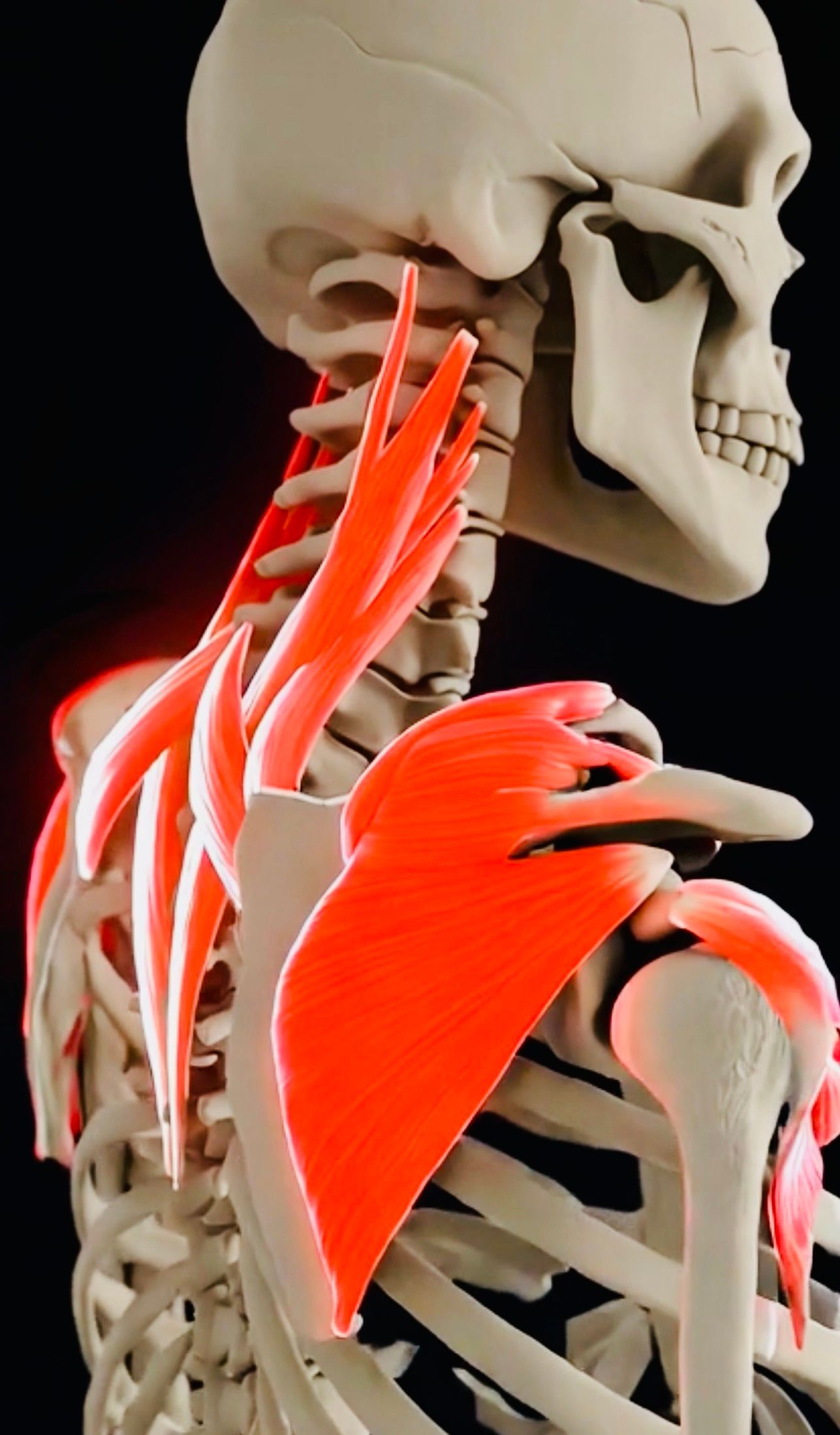 Physiotherapy for Dowager's hump and neck pain
