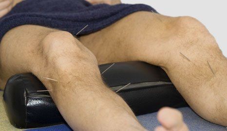 Medical acupuncture and sports massage, Leagrave, Luton