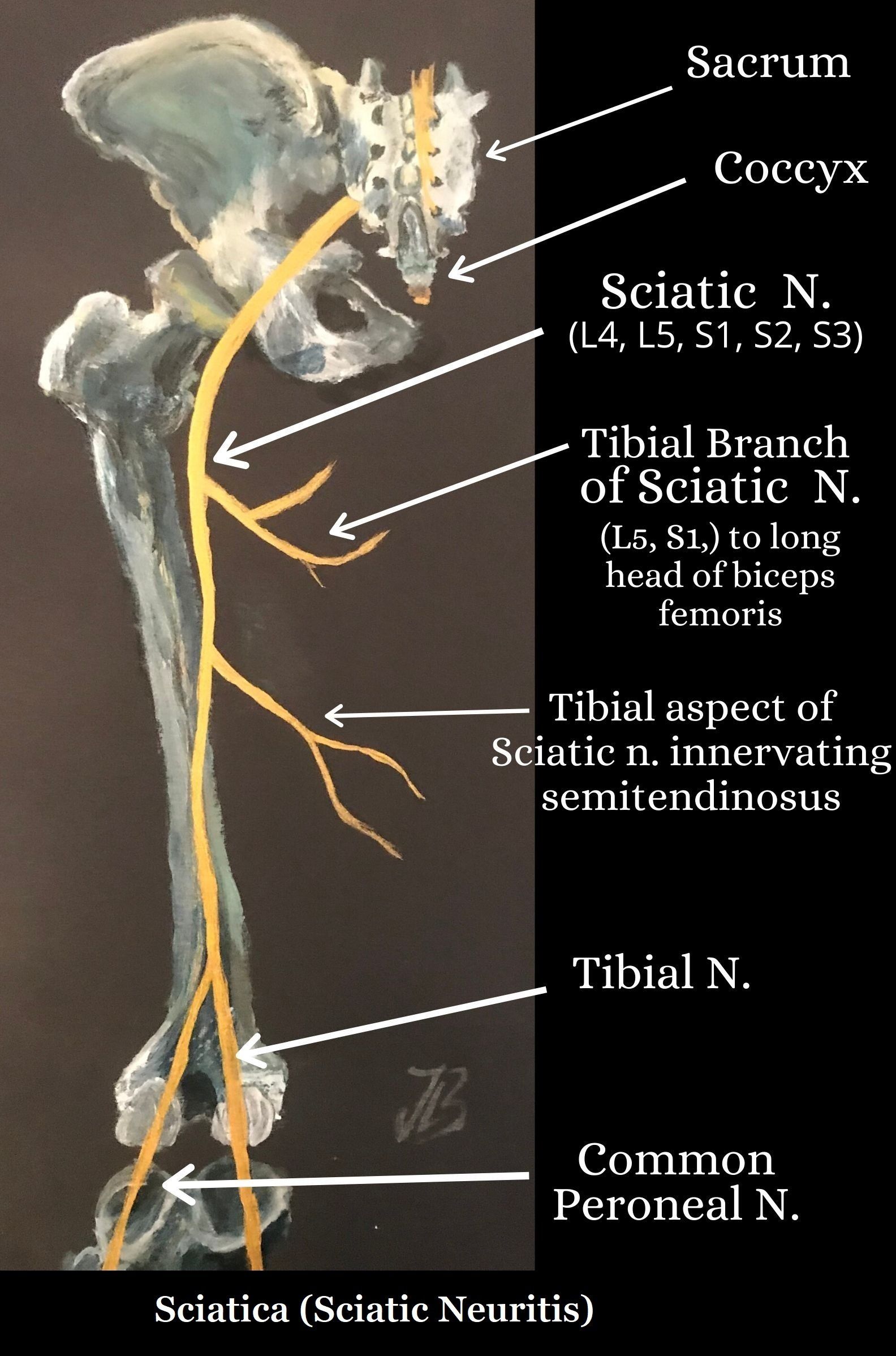 Sciatica Lower Back Pain The Sciatic Nerve