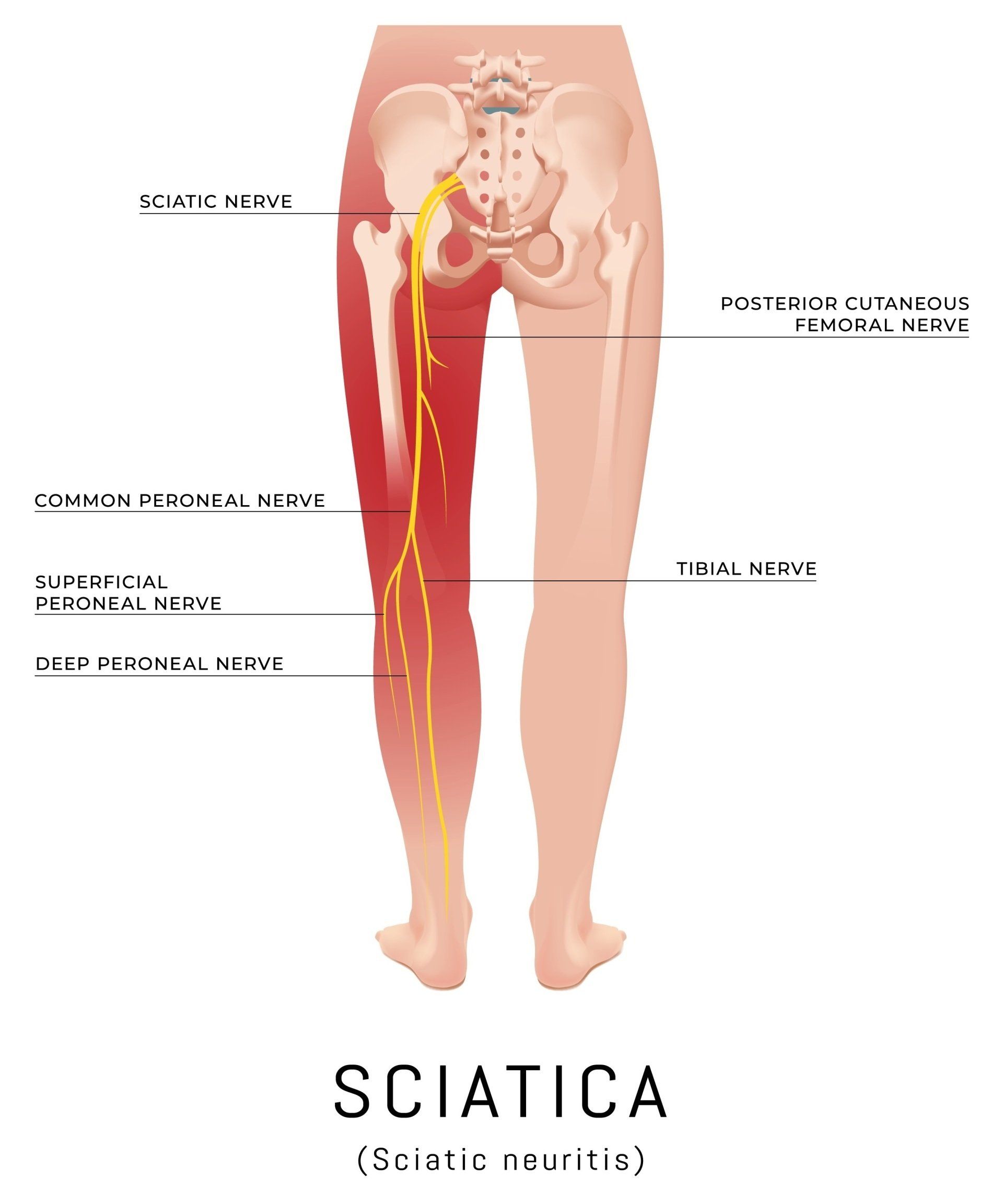 Anatomy of the sciatic nerve