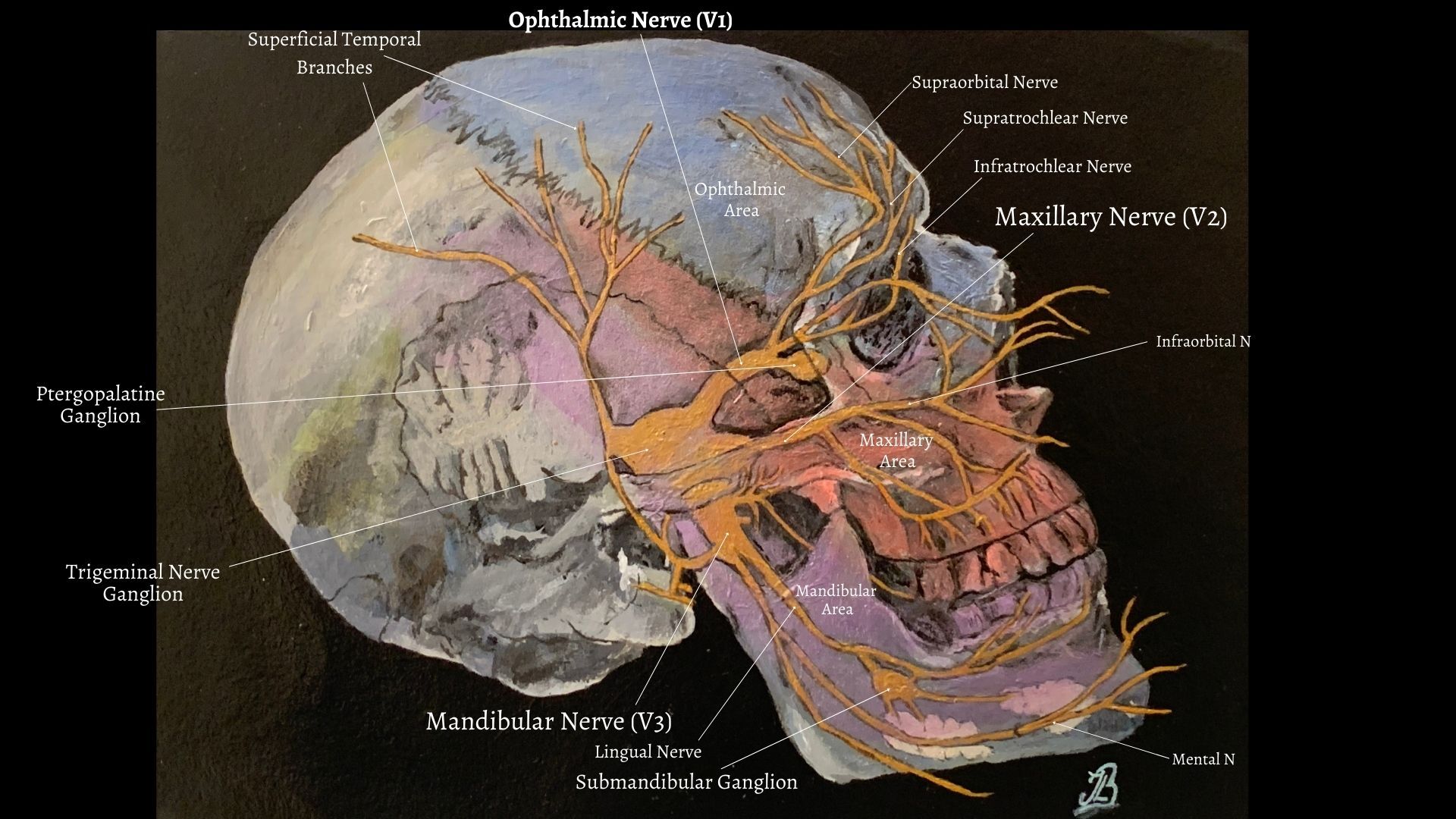 Trigeminal nerve side view with sensory areas highlighted 