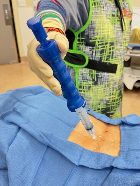 Syringe Assist | OrthoSpine