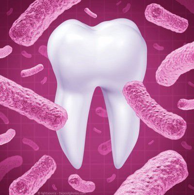 Pathogene Keime in der Mundhöhle können die Gesundheit gefährden