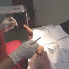 Podiatrist working on patient - foot care in Opelika, AL