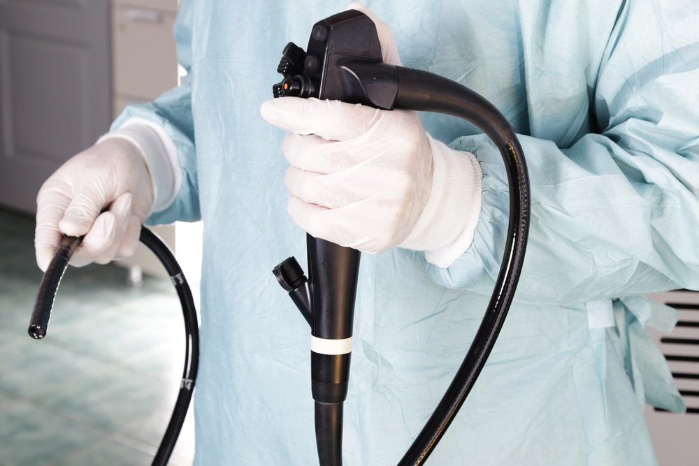 Endoscopy Being Performed — Endoscopist & General Surgeon in Mackay, QLD