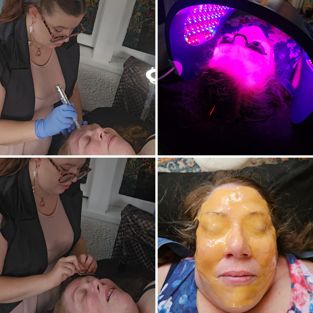 NanoGlow Facial with nanoneedling, celluma, gua sha and hydrojelly mask