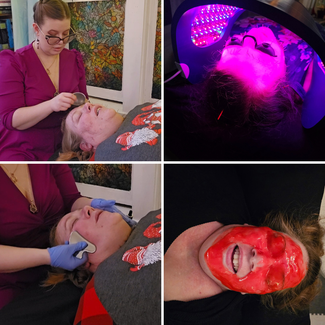 AcuGlow Facial treatments. Woman receives facial acupuncture, LED light therapy, facial gua sha and hydrojelly mask.