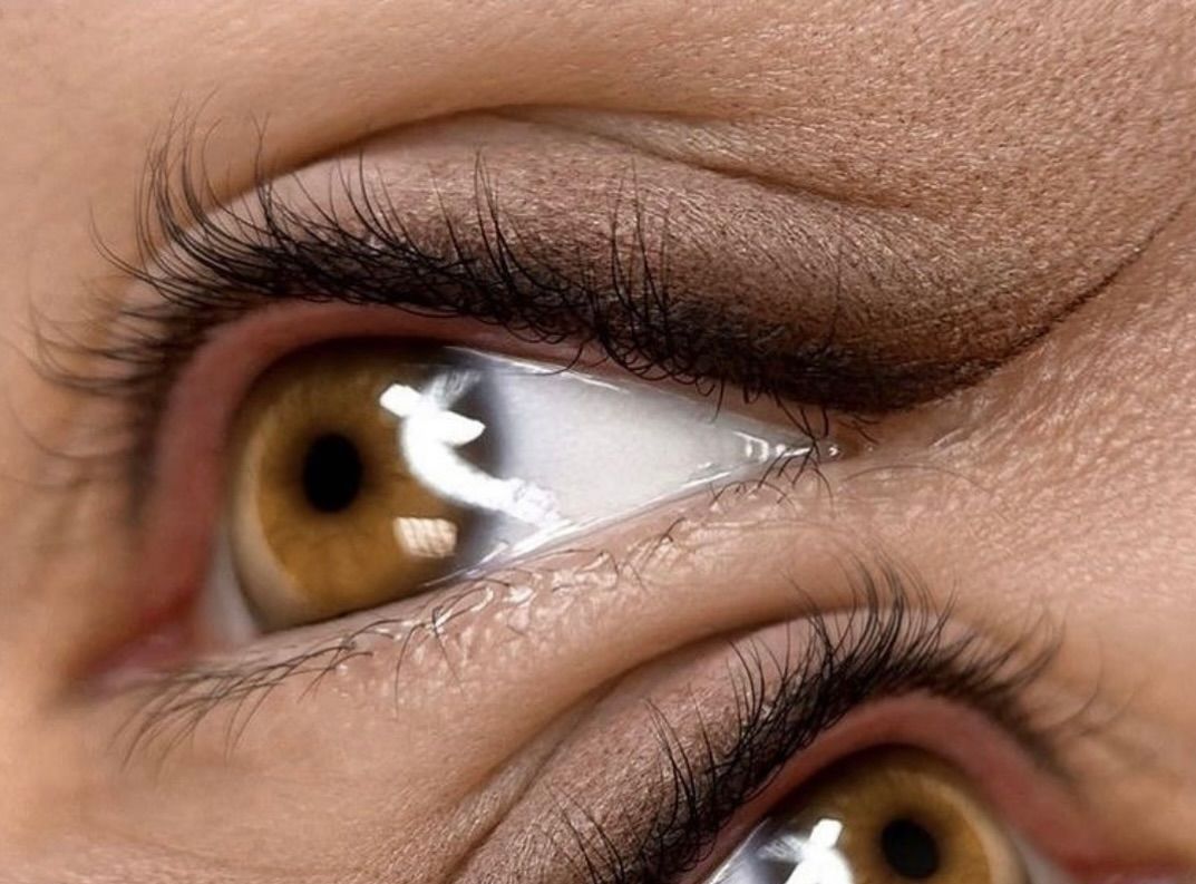 Un primo piano degli occhi marroni di una donna con la pupilla bianca.