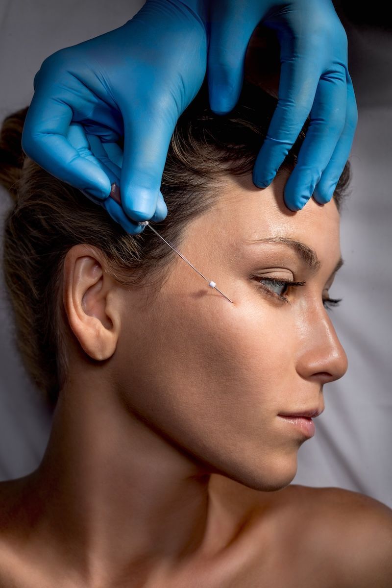 A woman is getting a botox injection in her forehead.