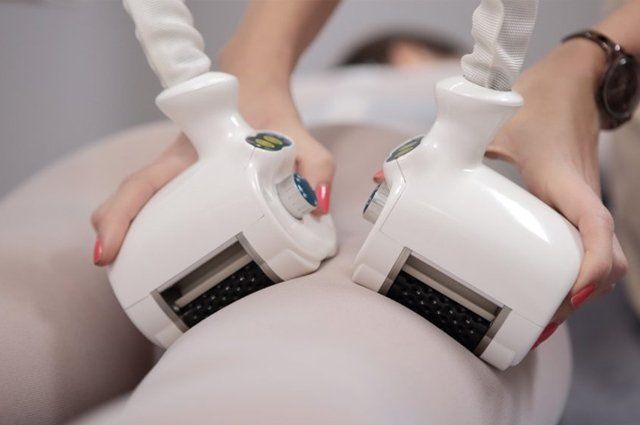 Stimolazione Microalveare