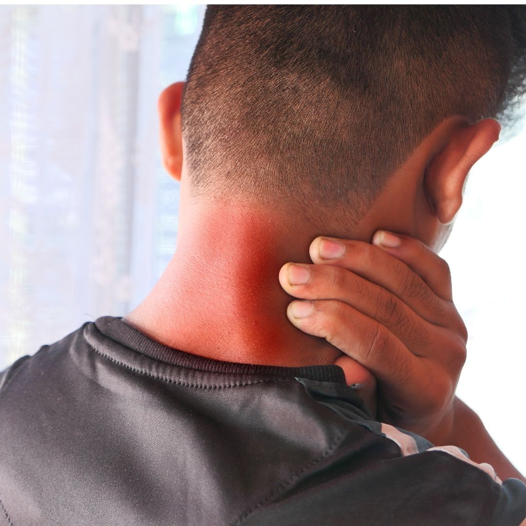Man holding his neck, showing a red, painful area, indicating neck pain.
