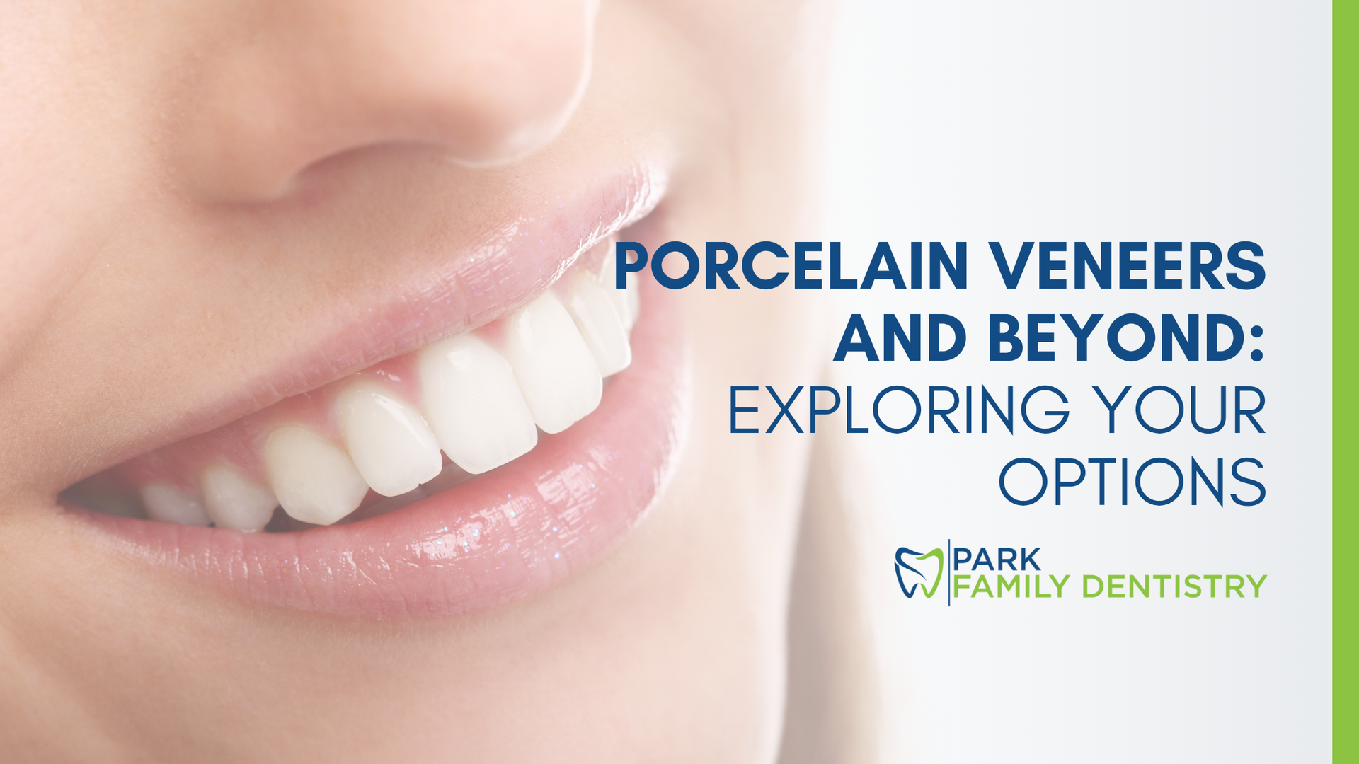 Porcelain veneers and beyond : exploring your options