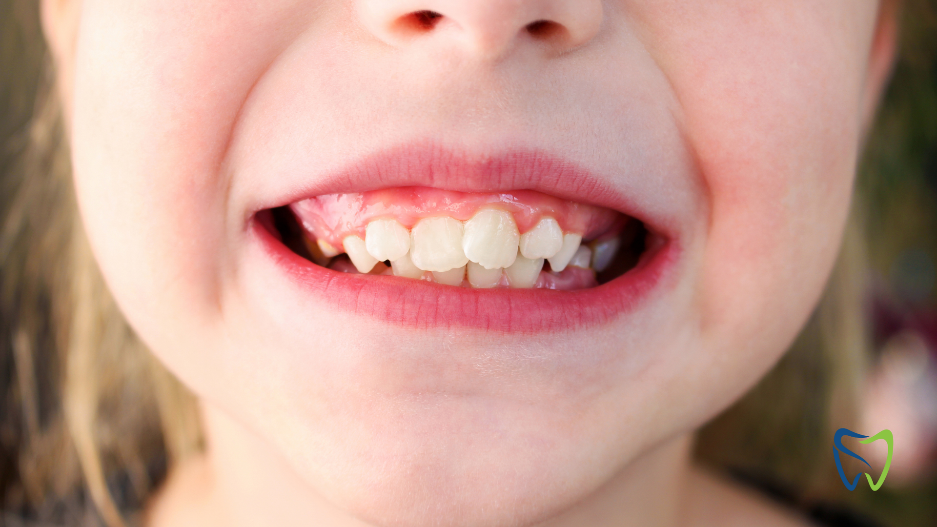 A close up of a child 's teeth with a smile on her face.