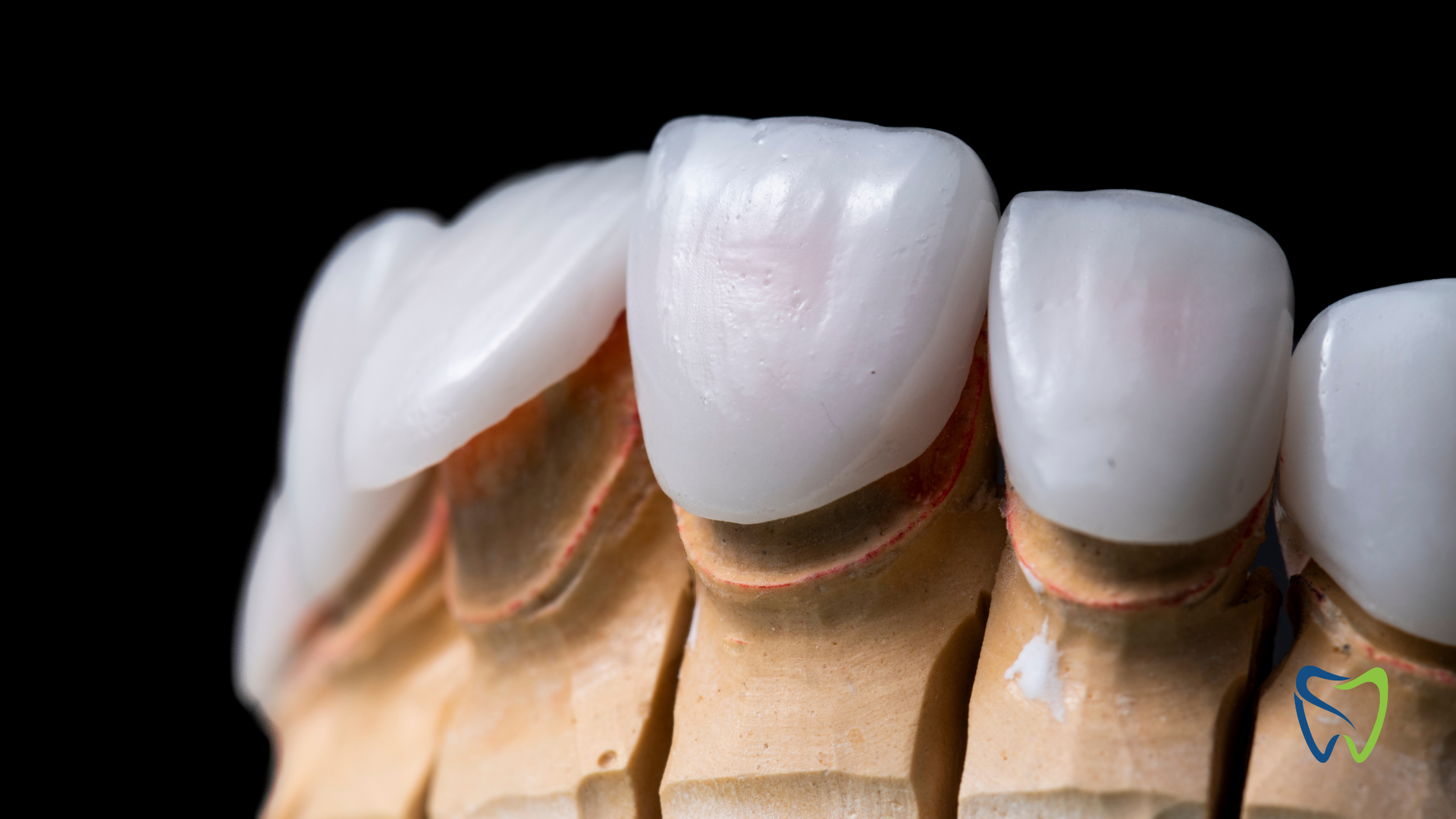 A close up of a model of a person 's teeth on a black background.