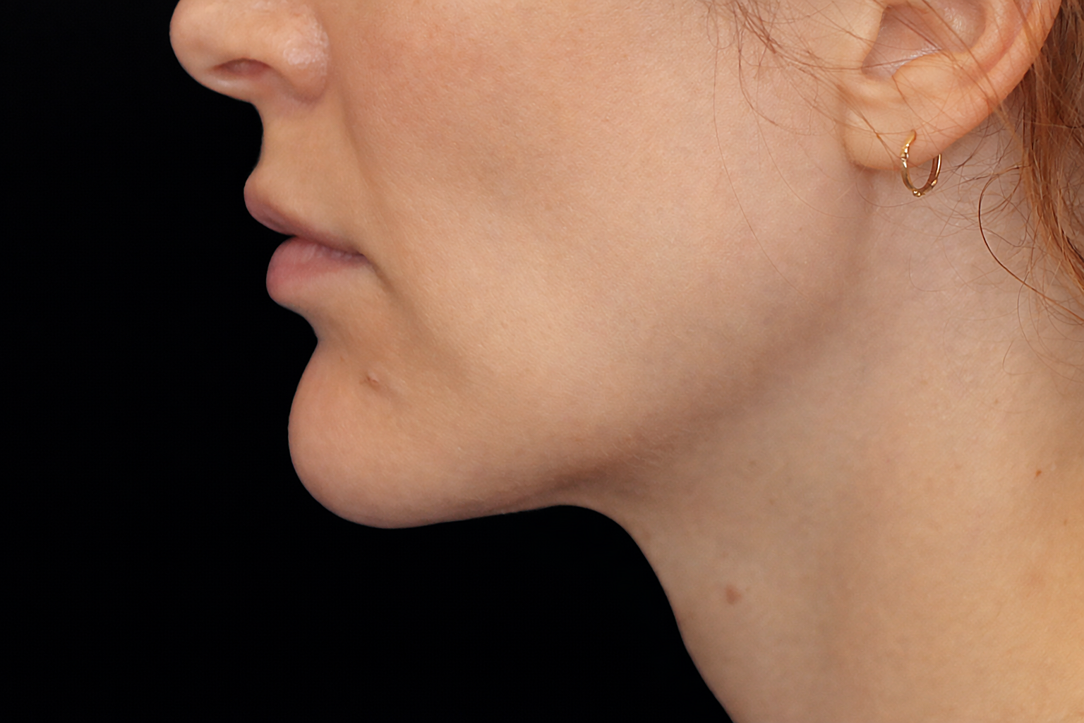Profile view of a person with a defined chin, smooth skin, and small earring against a black background.
