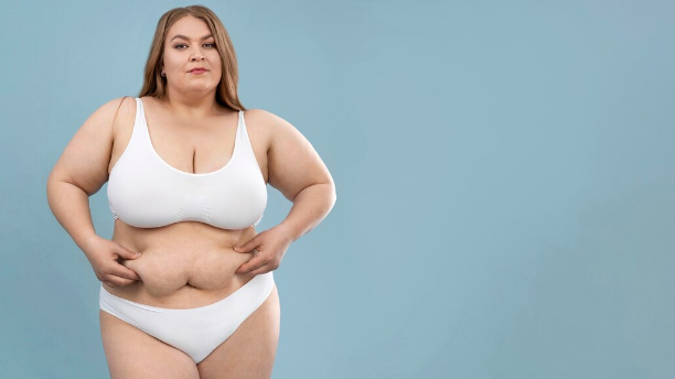 Mamoplastia pós-bariátrica em São Paulo: Reconstrução mamária após grande perda de peso