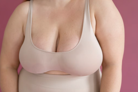 Quando é indicada a mamoplastia redutora em São Paulo Quando é indicada a mamoplastia redutora em São Paulo