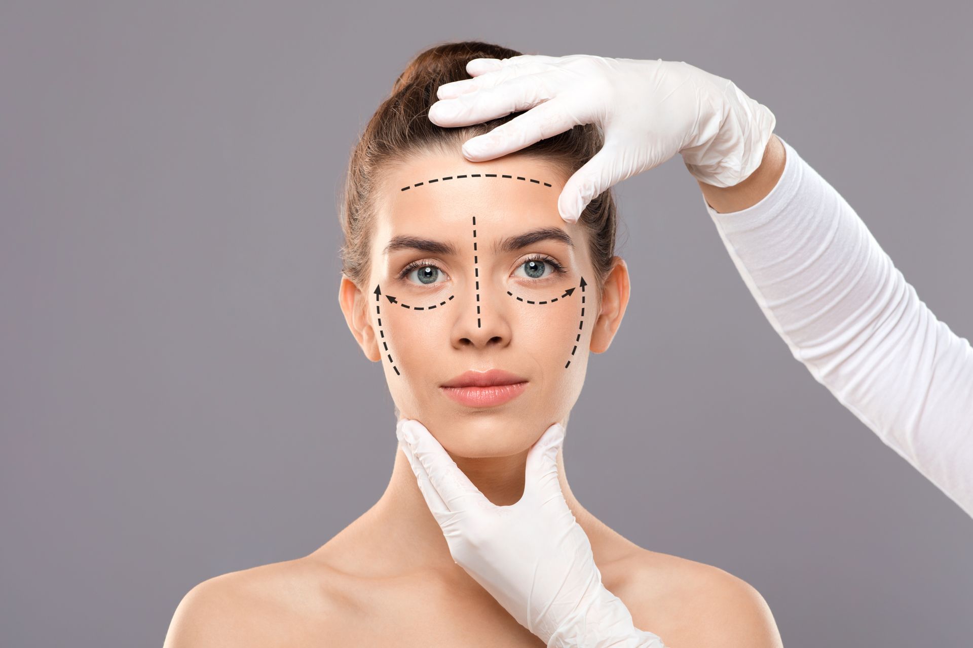 Rinoplastia estruturada ou preservadora: qual a melhor técnica para cada caso Rinoplastia estruturada ou preservadora qual a melhor técnica para cada caso