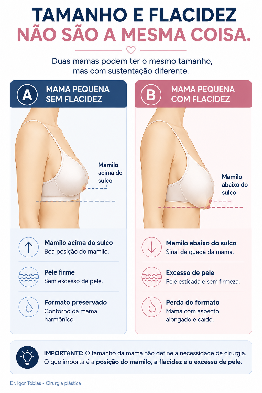 Infográfico comparando uma mama pequena sem flacidez e uma mama pequena com flacidez, mostrando a posição do mamilo em relação ao sulco inframamário e explicando que o tamanho da mama não determina a necessidade de mastopexia.