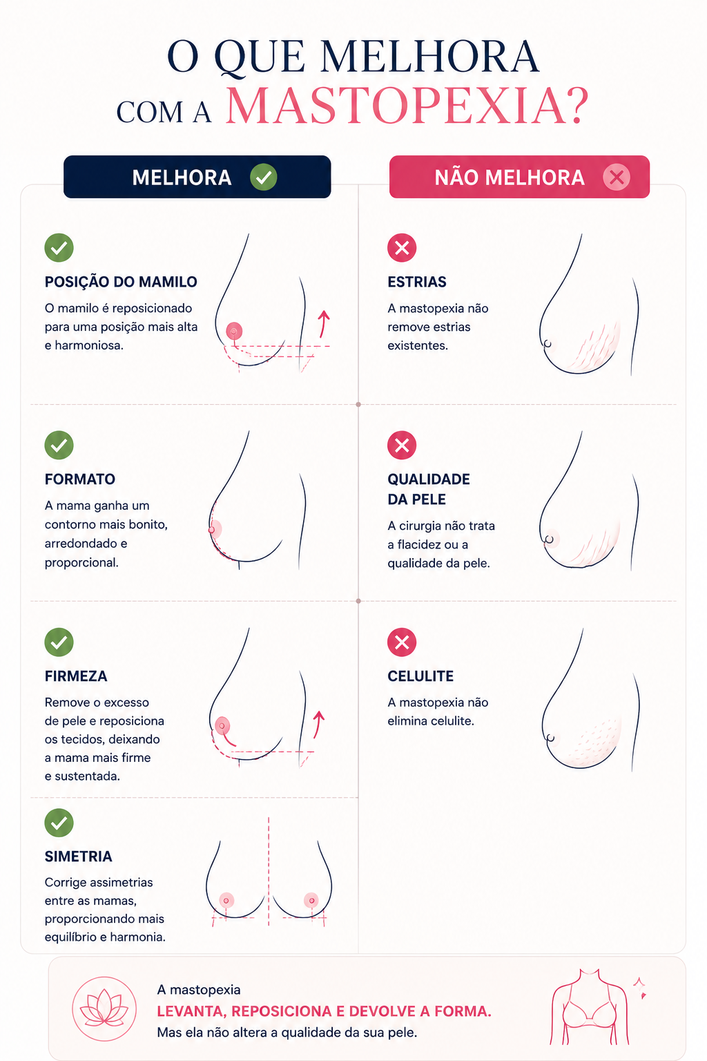Infográfico comparando o que melhora e o que não melhora com a mastopexia, mostrando que a cirurgia corrige a posição do mamilo, o formato, a firmeza e a simetria das mamas, mas não elimina estrias, não melhora a qualidade da pele nem trata celulite.