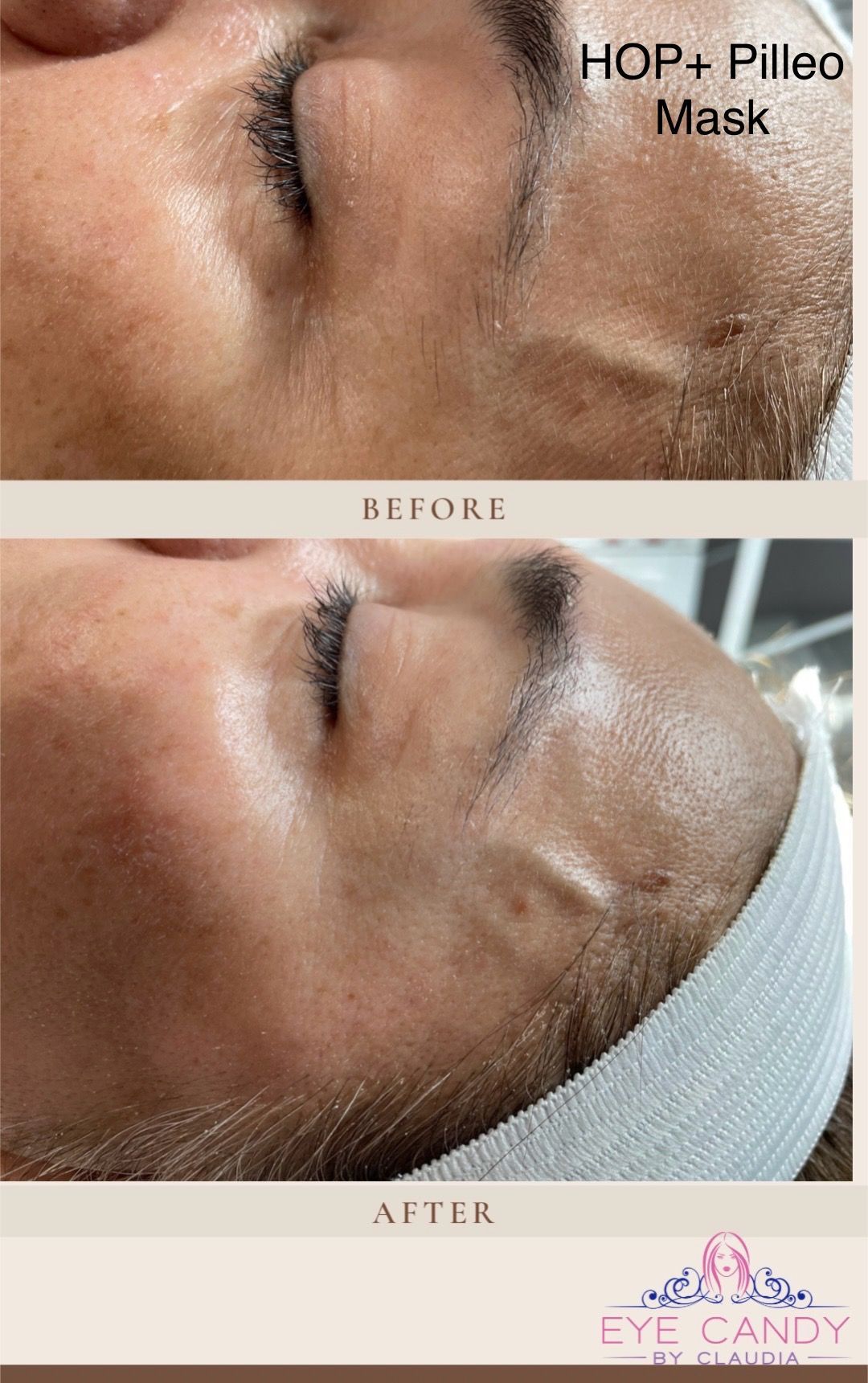 A before and after photo of a woman 's face with a mask on.