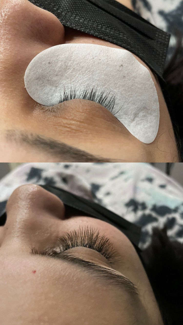 A close up of a woman 's eye with a patch on it.