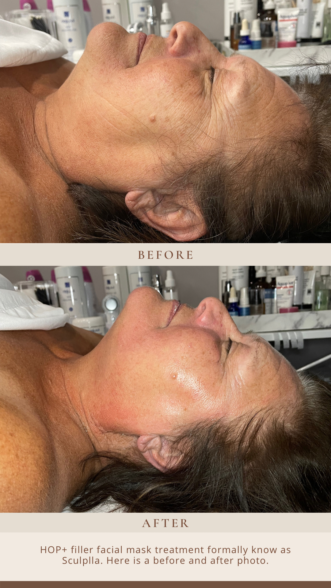 A before and after photo of a woman getting a facial treatment.