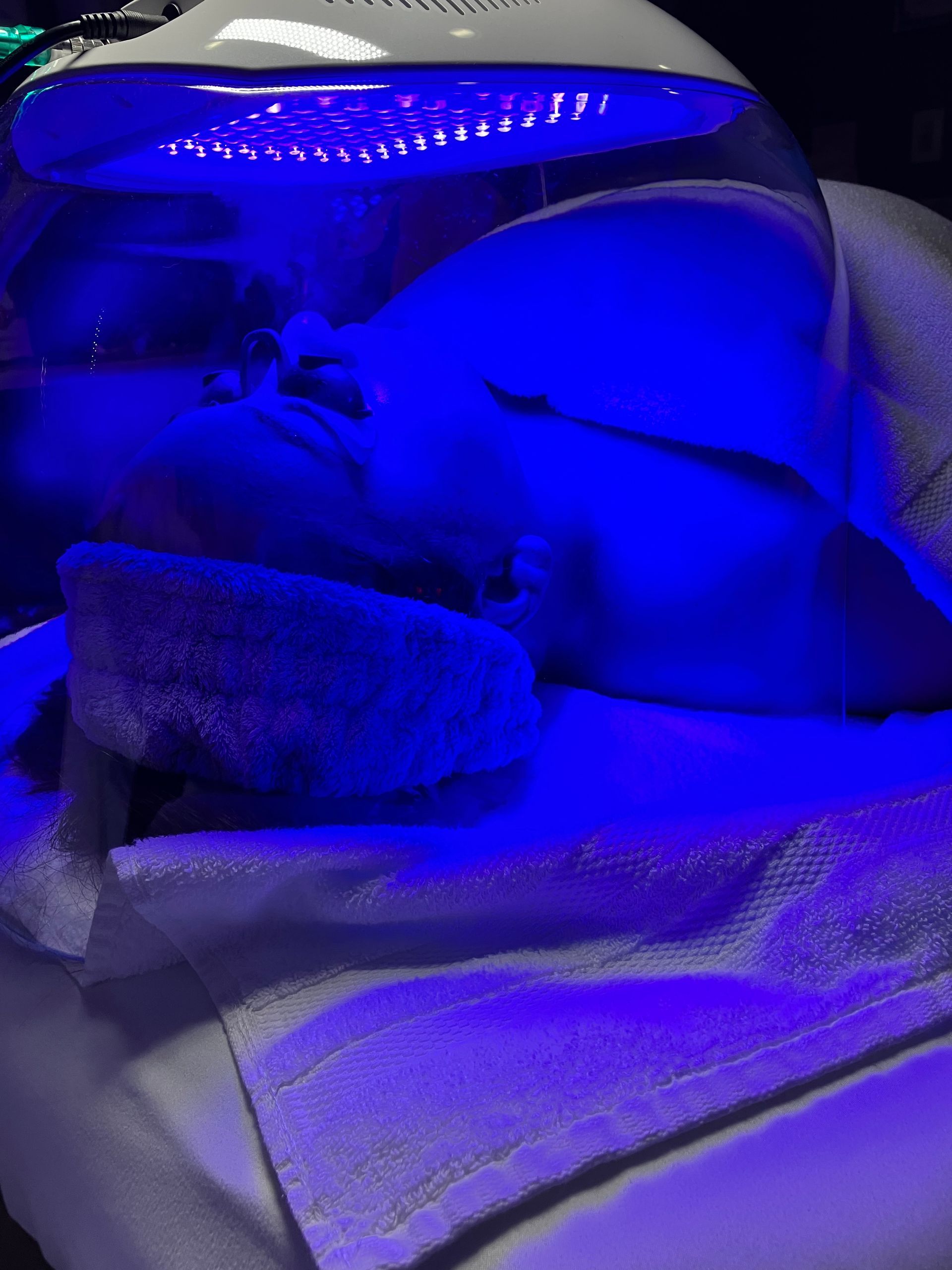 A person is getting a blue light treatment on their face.