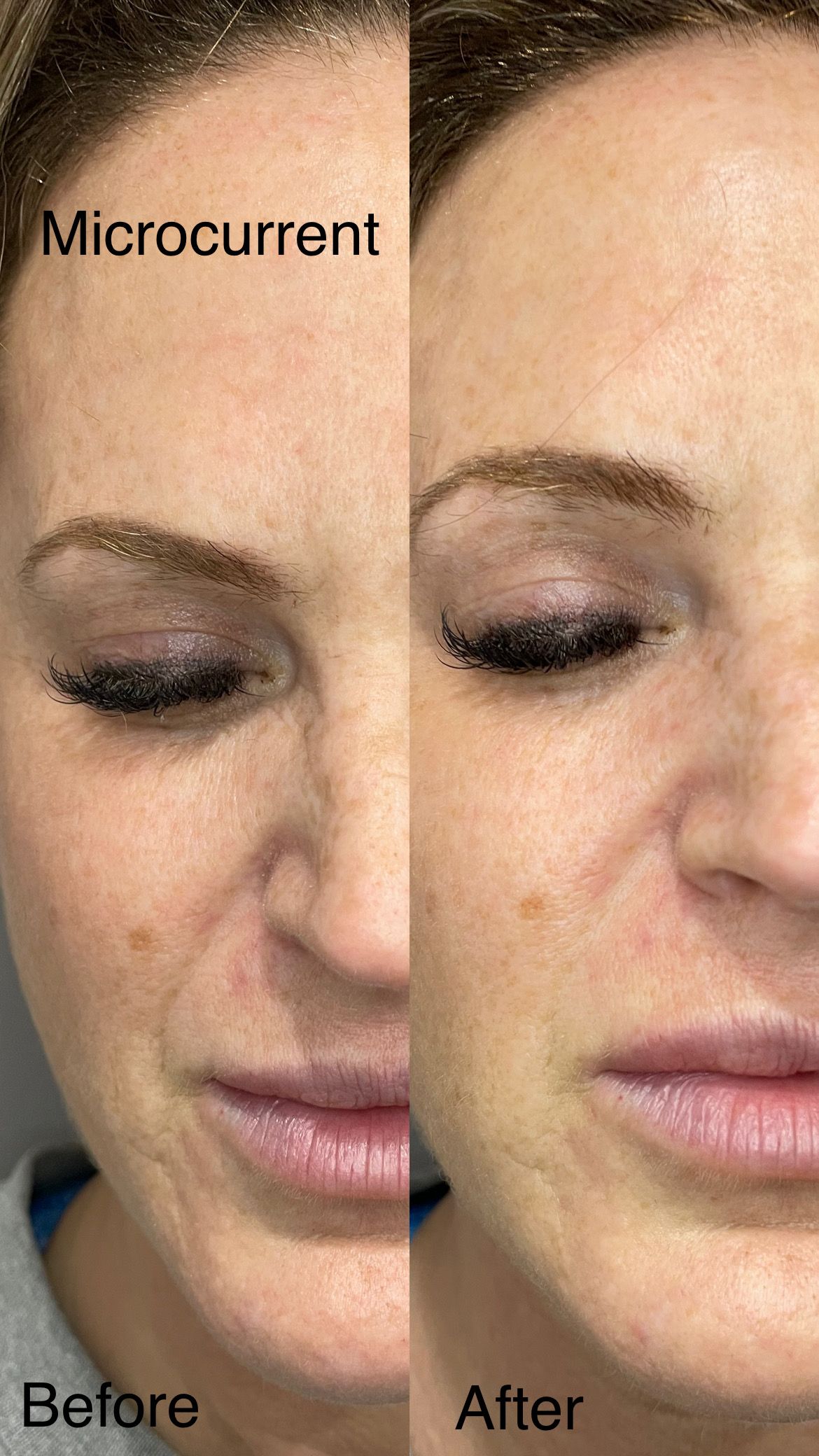 A before and after photo of a woman 's face.