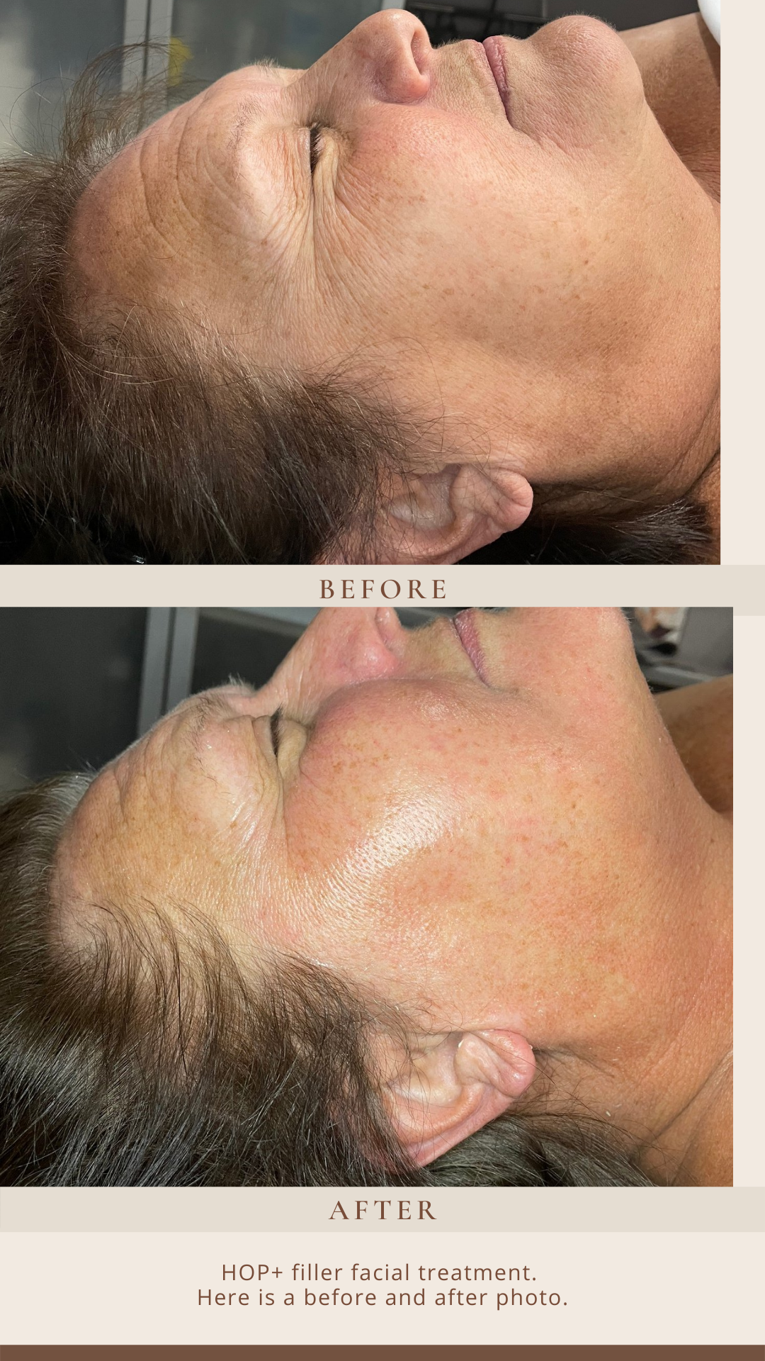 A before and after photo of a woman 's face.