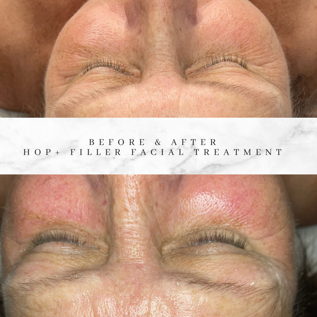 A before and after photo of a woman 's face with her eyes closed.