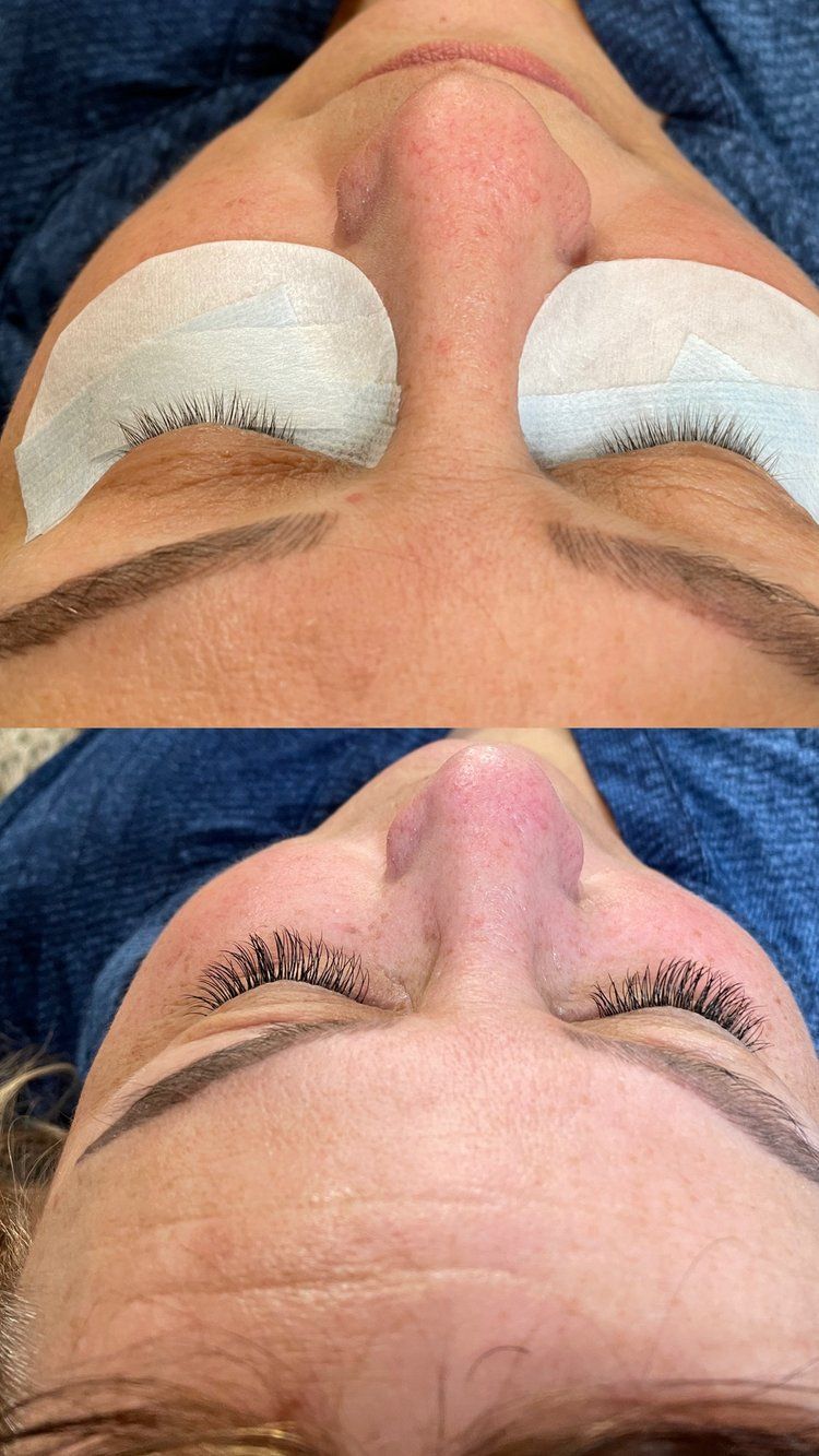 A before and after picture of a woman 's eyelashes.