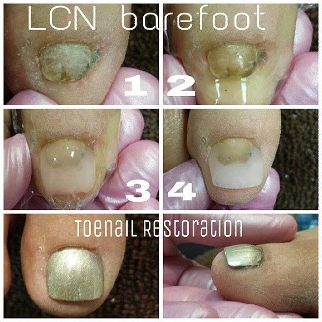 LCN Barefoot
