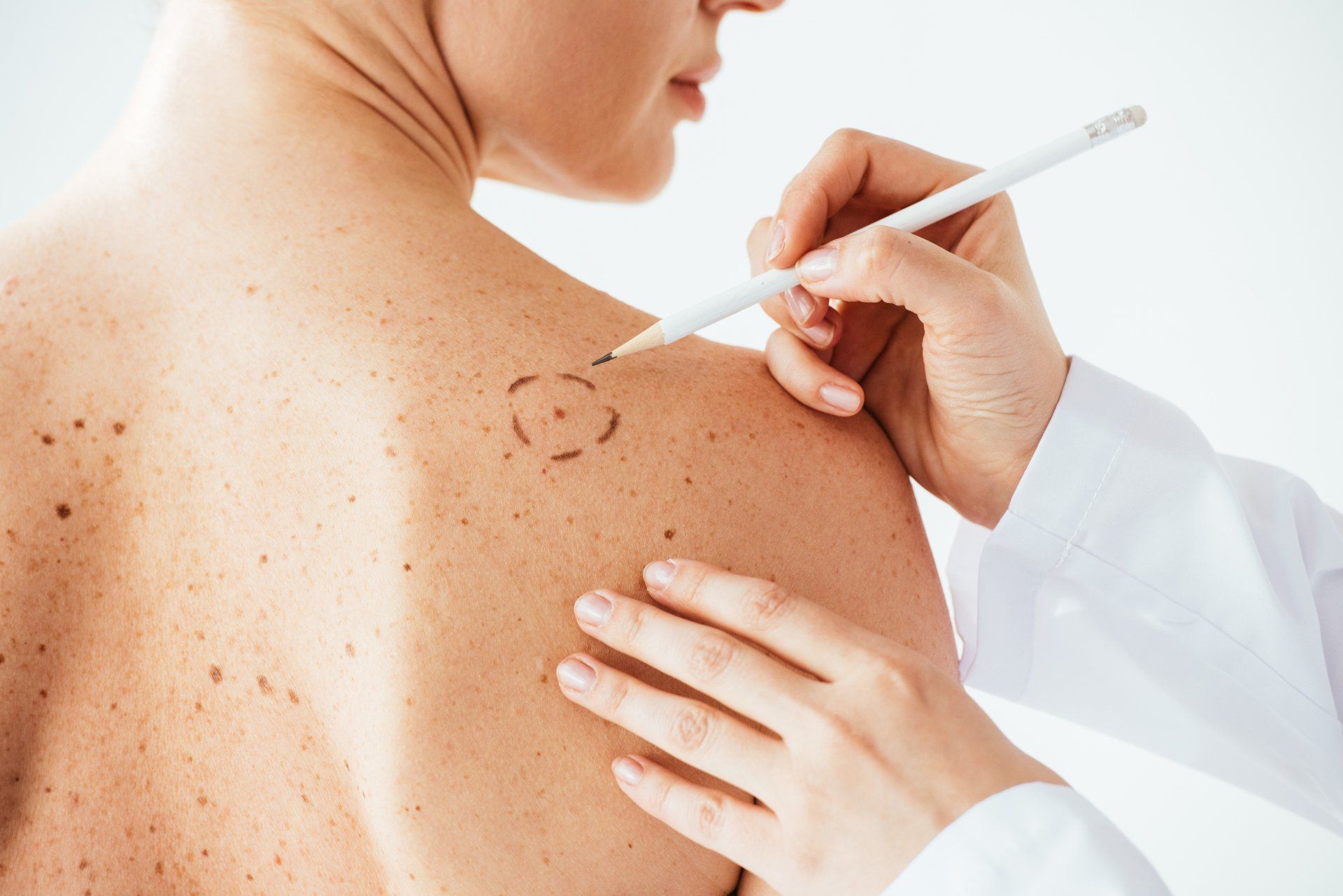 Un médico está dibujando un círculo en la espalda de una mujer con un marcador.