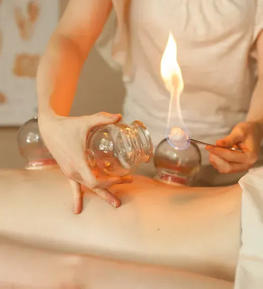 A woman is getting a cupping treatment on her leg.