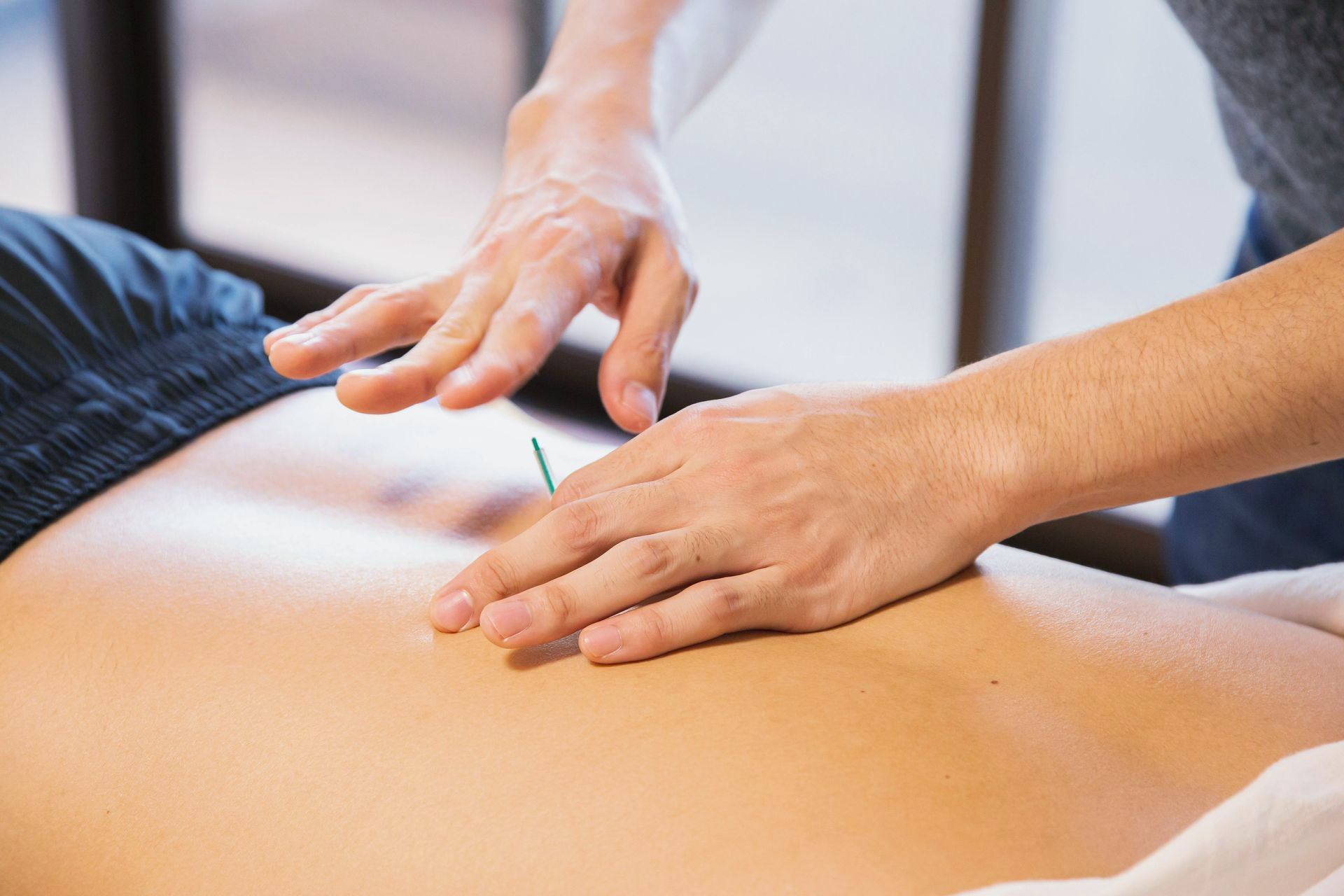A person is getting acupuncture on their stomach