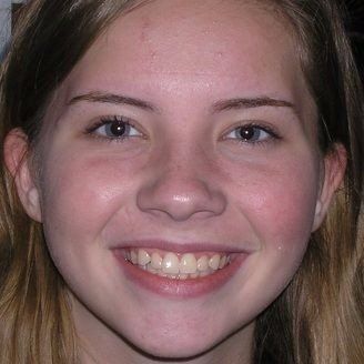 A close up of a young girl 's face smiling