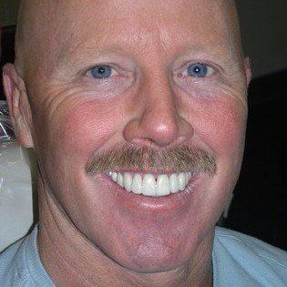 A bald man with a mustache and white teeth is smiling.