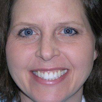 A woman with blue eyes and white teeth is smiling for the camera.