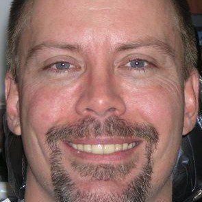 A man with a beard and mustache is smiling in a dental chair.