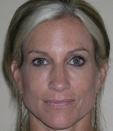 A close up of a woman 's face with earrings.