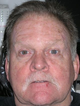 A close up of a man 's face with a mustache making a funny face.