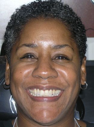 A close up of a woman 's face with a smile on her face