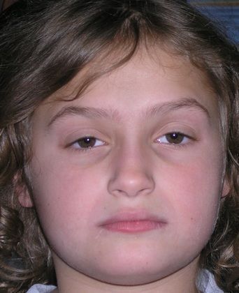 A close up of a young girl 's face with a sad look on her face.