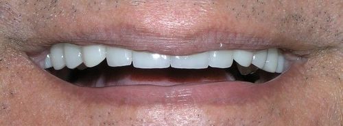 A close up of a man 's mouth with white teeth.