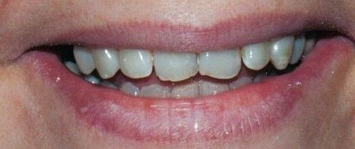 A close up of a person 's mouth with white teeth.