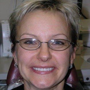 A woman wearing glasses is smiling in a dental chair.