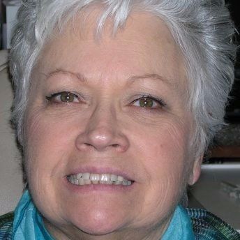 A close up of a woman 's face with gray hair and a blue scarf.